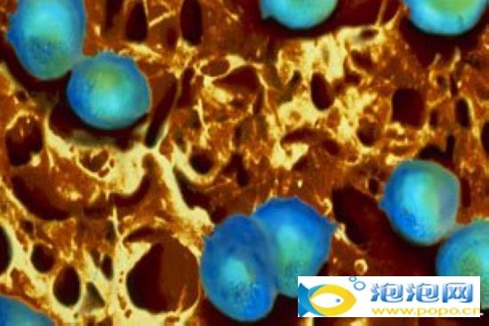 超级淋病病毒是什么 超级淋病病毒h041介绍及传播