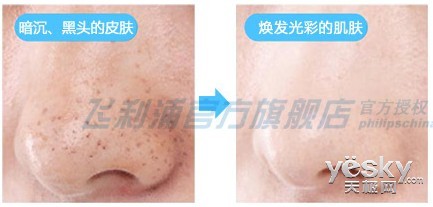 洁肤美容神器 飞利浦净颜焕采洁肤仪推介