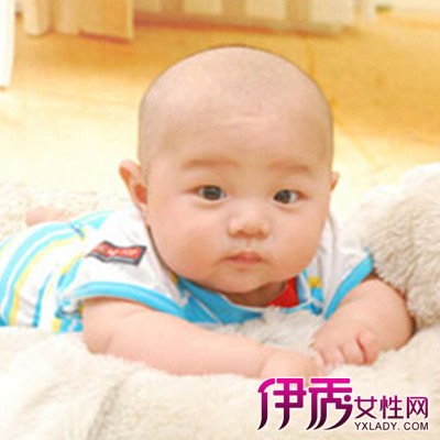 良性颅内压增高综合征_宝宝颅内压增高危险吗_i婴儿颅内压增高