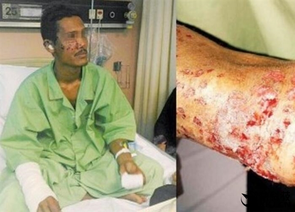 手机充电时来电_手机充电接电话爆炸_充着电接电话的危害