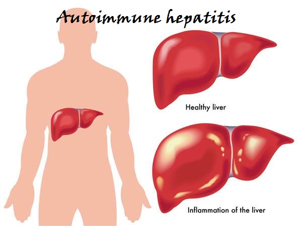mapk信号通路_信号转导通路_mif介导信号通路