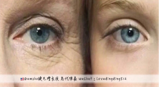 gemsho睫美秀_睫毛生长液gemsho_gemsho 副作用