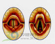 电脑声音很小_声音哑了怎么快速恢复_电脑声音嘶哑的原因