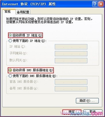 把IP地址设置为自动获得