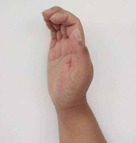 用鼠标小拇指疼_长时间用鼠标手腕疼_用鼠标手腕疼