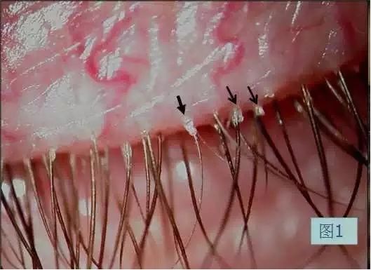 dk战队老板_为什么现在cf战队系统在游戏上战队成员都不显示_dk战队 砸显示器