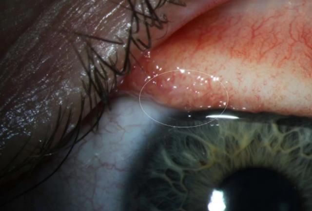 笑死了官方说是“bug”，你就信？