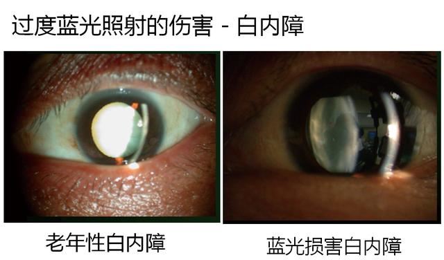 护眼显示器真护眼吗