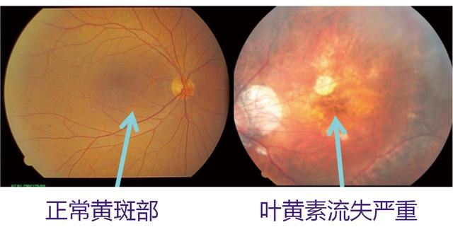 护眼显示器真护眼吗