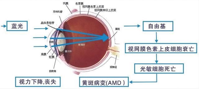 护眼显示器真护眼吗