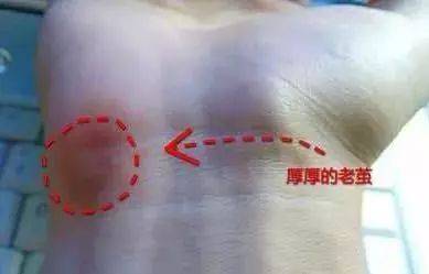 不累手的鼠标