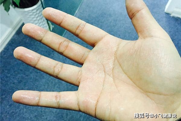 手小游戏鼠标推荐_手出汗用什么鼠标_不累手的鼠标