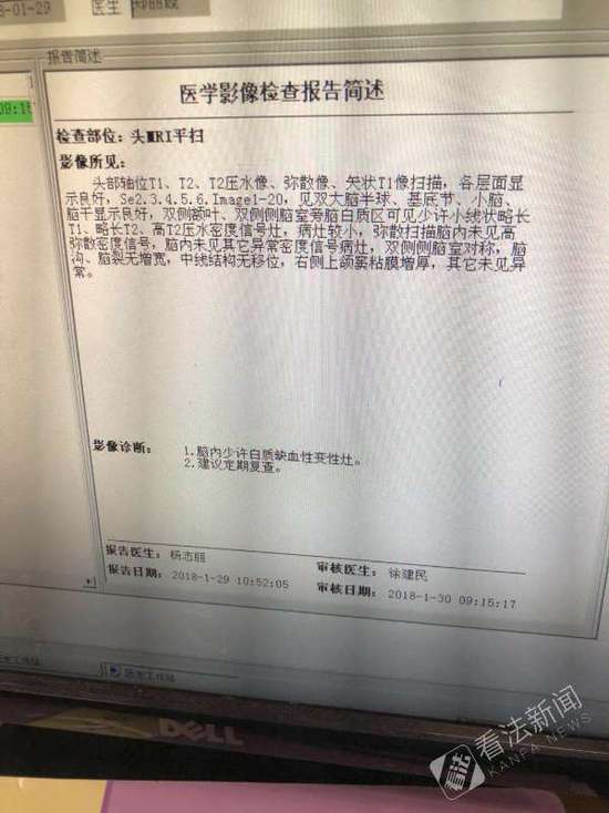 显示器接显卡没信号_显卡 显示器没信号_显示器接显卡没信号