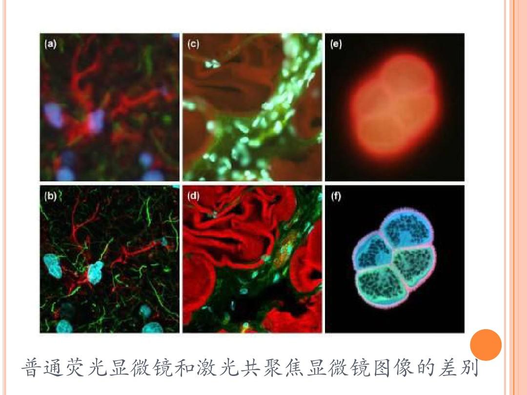 crt显示器的缺点_crt显示原理_crt 不能完全显示配置