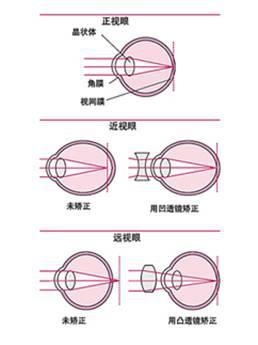 笔记本显示器反光