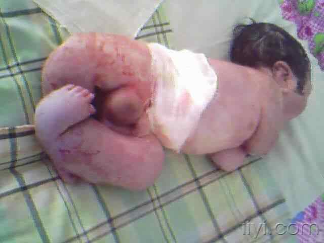 亲宝宝软件 泄密_亲宝宝软件安全吗_宝宝巴士宝宝居家安全