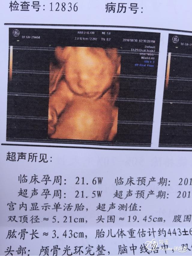 孕期做哪些检查_孕期检查时间表 excel_孕期必要检查