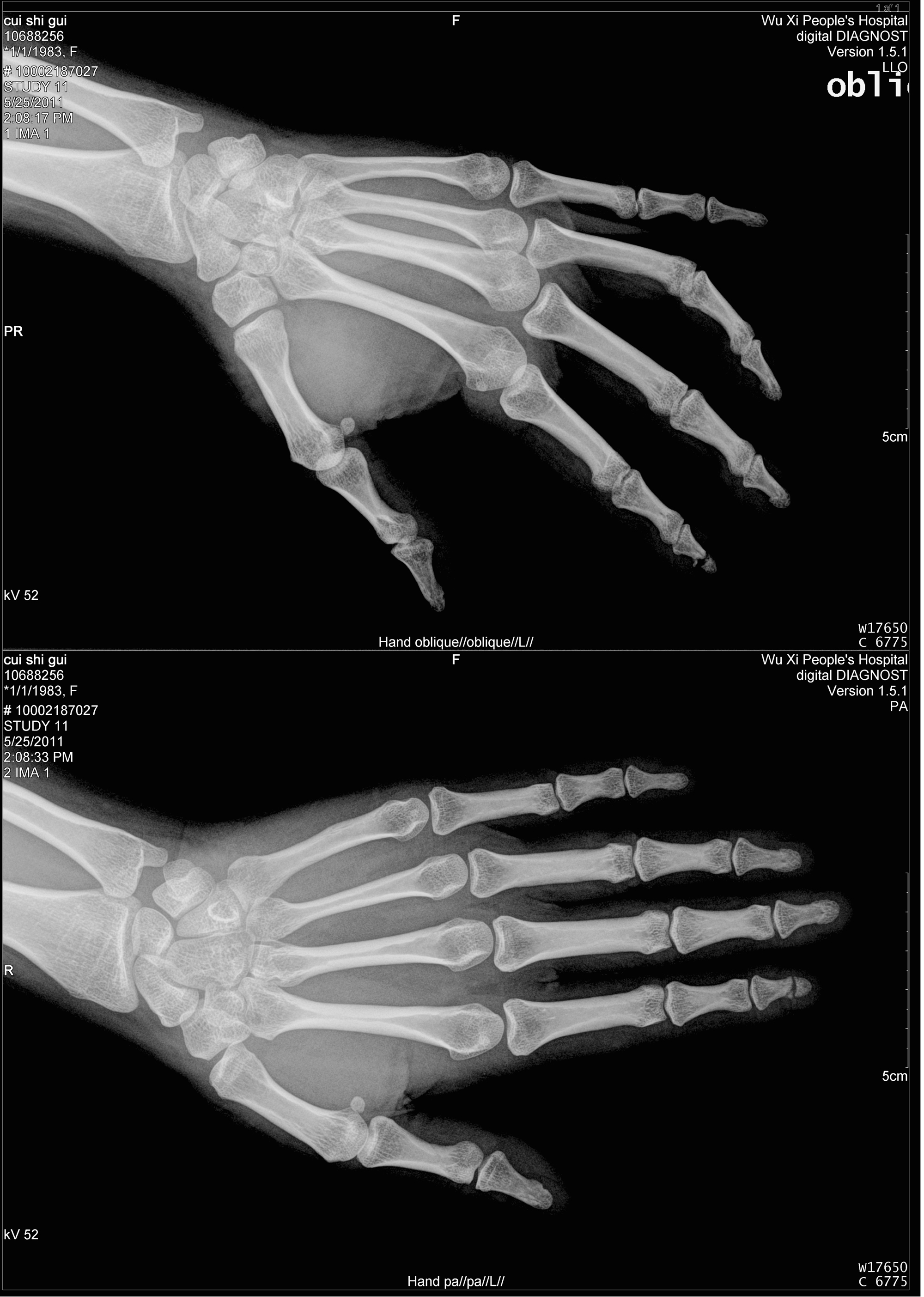医用显示器显卡