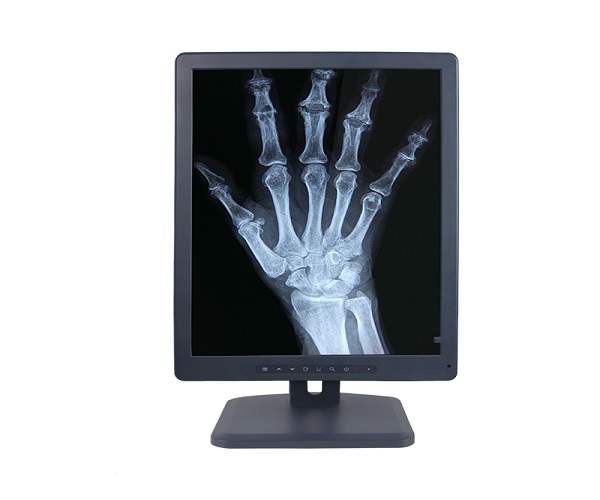 2mp诊断级灰阶显示器哪家好