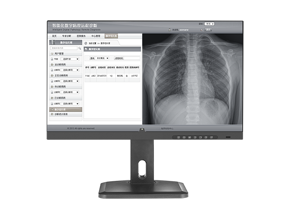 2mp诊断级灰阶显示器哪家好