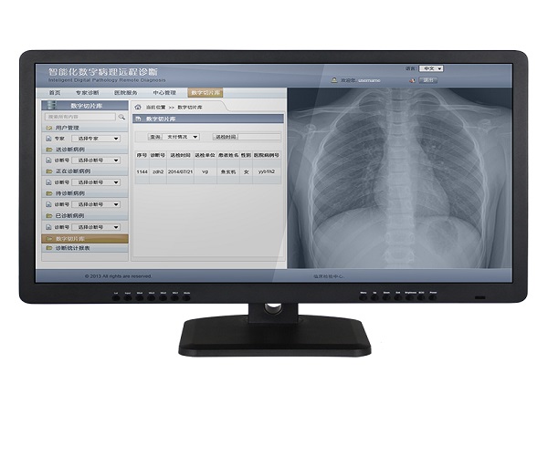 2mp诊断级灰阶显示器哪家好