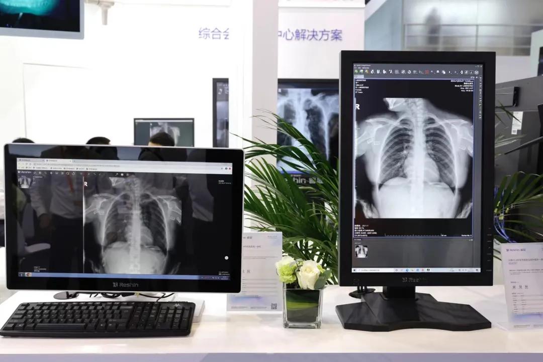 2mp诊断级灰阶显示器哪家好_诊断卡显示7f怎么刷bios_诊断显示网卡未启用